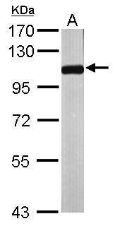 NPEPPS Rabbit Polyclonal Antibody