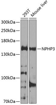 NPHP3 antibody