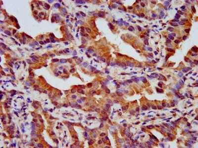 NPHP4 Antibody