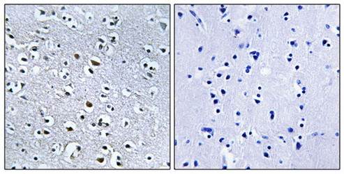 NPHP4 Antibody