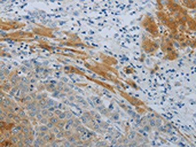 NPHS1 Antibody