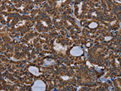 NPHS2 Antibody