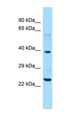 NPIPA1 antibody