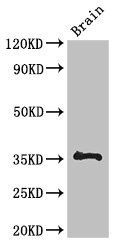 NPL Antibody