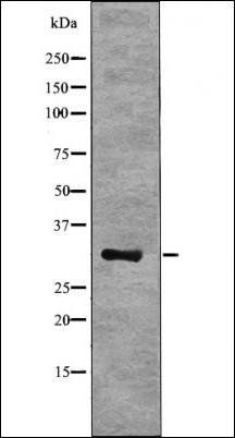 NPM (Phospho-Thr237) antibody