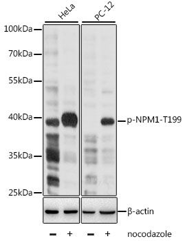 NPM1 (Phospho-T199) antibody
