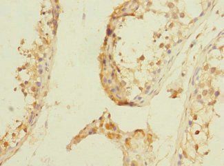 NPM2 Antibody