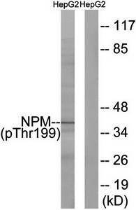 SOCS3 antibody