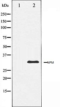 NPM antibody