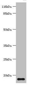 NPPB antibody