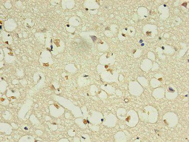 NPPB Monoclonal Antibody