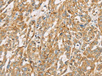 NPPB Antibody