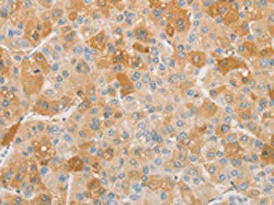 NPPB antibody