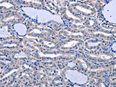 NPPB antibody