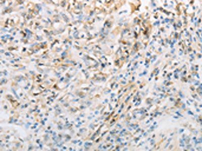 NPPC Antibody