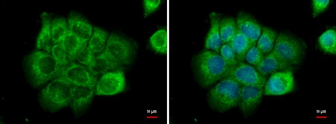 NPR-C antibody [N3C3]