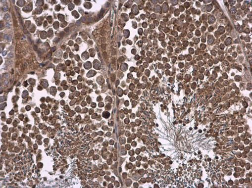 NPR-C Rabbit Polyclonal Antibody