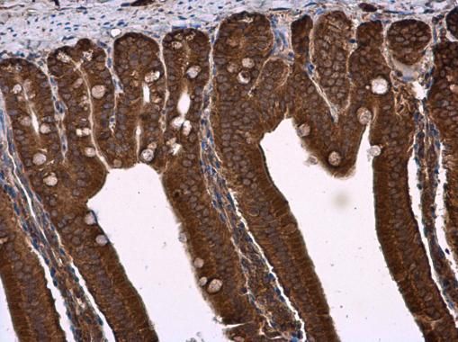 NPR-C Rabbit Polyclonal Antibody