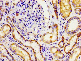 NPR3 Antibody
