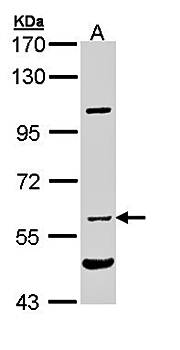 NPR-C antibody