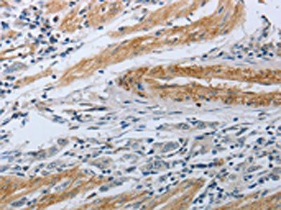 NPR1 Antibody