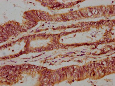 NPRL3 Antibody