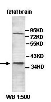 NPSR1 Rabbit Polyclonal Antibody
