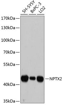 NPTX2 antibody