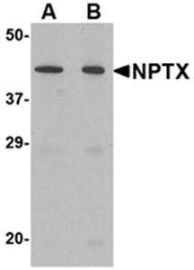 NPTX2 Antibody