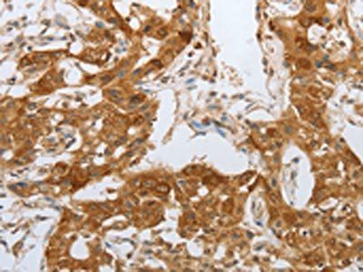NPY1R Antibody