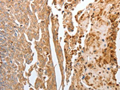 NPY1R Antibody