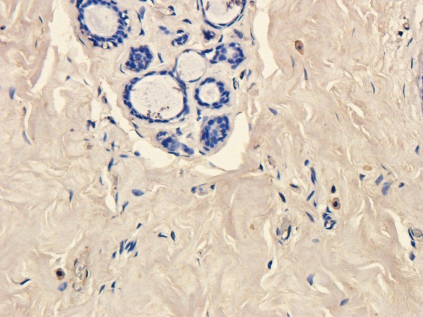 NPY1R antibody