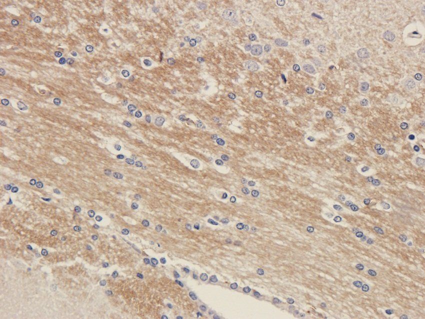 NPY1R antibody