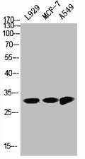 NQO1 Antibody