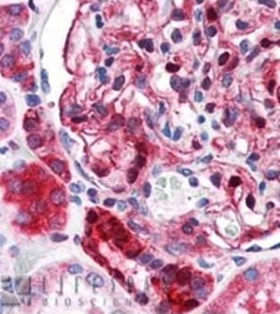 NQO1 Monoclonal Antibody [A180] - 50ul