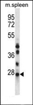 NQO2 antibody