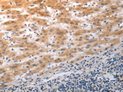 NQO2 Antibody