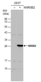 NR0B2 Rabbit Polyclonal Antibody