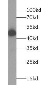 NR1H3 antibody