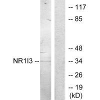 NR1I3 antibody