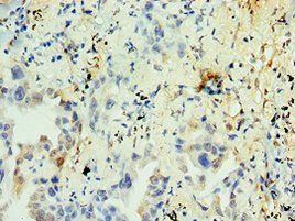 NR2C2 Antibody