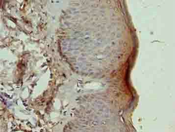 NR2C2AP Antibody