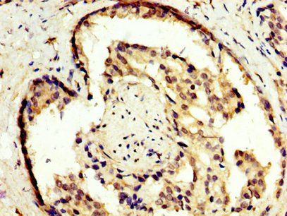 NR2E3 Antibody