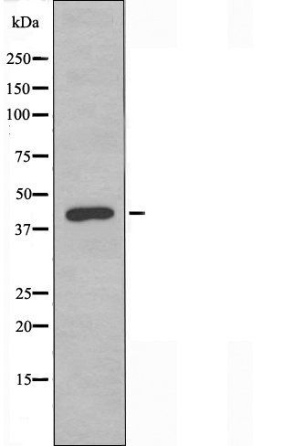 NR2F6 antibody