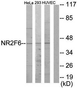 NR2F6 antibody