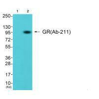 NR3C1 (Ab-211) Antibody