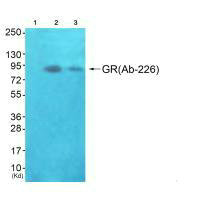 NR3C1 (Ab-226) antibody
