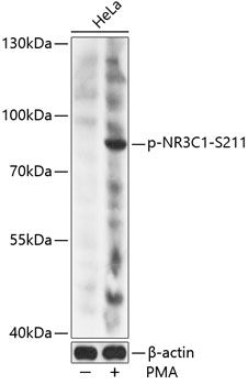 NR3C1 (Phospho-S211) antibody