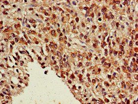 NR5A2 Antibody