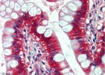 Goat anti-NRAS Antibody